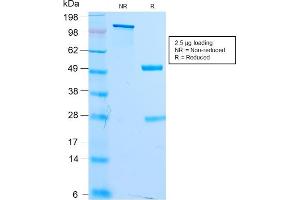 SDS-PAGE Analysis Purified MITF Recombinant Rabbit Monoclonal Antibody (MITF/2987R). (Recombinant MITF 抗体)