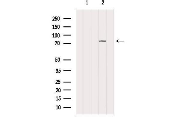 PARP2 抗体  (Internal Region)