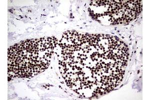 Image no. 1 for anti-Nibrin (NBN) (AA 183-460) antibody (ABIN1491058) (Nibrin 抗体  (AA 183-460))