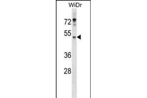 EN Antibody (Center) (ABIN1537947 and ABIN2849680) western blot analysis in WiDr cell line lysates (35 μg/lane). (ENPP4 抗体  (AA 171-200))