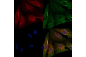 ABIN6263511 and ABIN6276331 staining  cells by IF/ICC. (NAMPT 抗体  (C-Term))