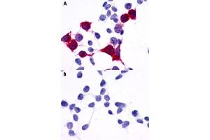 Immunocytochemical staining of HEK293 human embryonic kidney cells transfected (A) and untransfected (B) with GPR137B. (GPR137B 抗体  (C-Term))