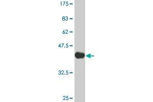 Western Blot detection against Immunogen (36. (IRAK2 抗体  (AA 111-210))