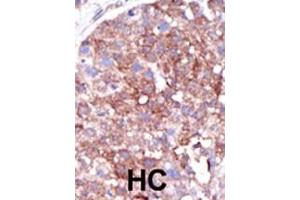 Immunohistochemistry (Paraffin-embedded Sections) (IHC (p)) image for anti-SMAD Specific E3 Ubiquitin Protein Ligase 1 (SMURF1) (AA 711-740), (C-Term) antibody (ABIN388829)