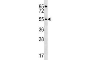 Western Blotting (WB) image for anti-V-Akt Murine Thymoma Viral Oncogene Homolog 1 (AKT1) (AA 115-144) antibody (ABIN3029459)