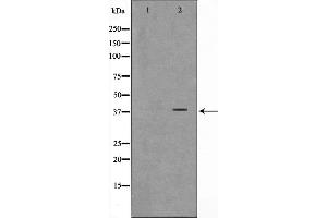 Western blot analysis on K562 cell lysate using ARMX3 Antibody,The lane on the left is treated with the antigen-specific peptide. (ARMCX3 抗体  (N-Term))