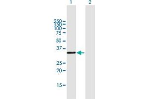 Western Blot analysis of KIAA1530 expression in transfected 293T cell line by KIAA1530 MaxPab polyclonal antibody. (UVSSA/KIAA1530 抗体  (AA 1-260))