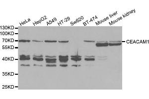 Western blot analysis of extracts of various cell lines, using CEACAM1 antibody. (CEACAM1 抗体  (AA 300-430))