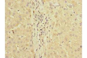 Immunohistochemistry of paraffin-embedded human liver tissue using ABIN7163092 at dilution of 1:100 (PDCL2 抗体  (AA 1-241))
