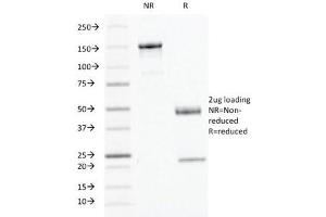 SDS-PAGE Analysis of Purified, BSA-Free IFN gamma Antibody (clone IFNG/466). (Interferon gamma 抗体)