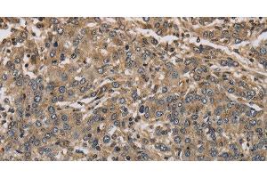 Immunohistochemistry (Paraffin-embedded Sections) (IHC (p)) image for anti-Potassium Voltage-Gated Channel, Shaker-Related Subfamily, Member 7 (KCNA7) antibody (ABIN7239125)
