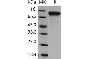 Western Blotting (WB) image for Discoidin Domain Receptor tyrosine Kinase 2 (DDR2) (Active) protein (His tag) (ABIN7320240) (DDR2 Protein (His tag))