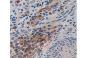 IHC-P analysis of Human Tissue, with DAB staining. (FBLN4 抗体  (AA 278-366))