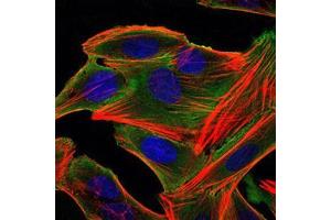 Immunofluorescence (IF) image for anti-Ribosomal Protein S6 Kinase, 90kDa, Polypeptide 3 (RPS6KA3) antibody (ABIN969386)