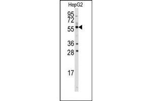 Image no. 1 for anti-Aldehyde Dehydrogenase 3 Family, Member B1 (ALDH3B1) (C-Term) antibody (ABIN360239) (ALDH3B1 抗体  (C-Term))