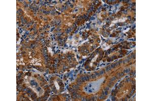 Immunohistochemistry (IHC) image for anti-P53-Induced Death Domain Protein (PIDD) antibody (ABIN2423739) (PIDD 抗体)