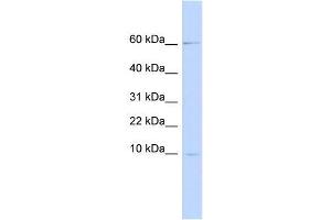 Image no. 1 for anti-Peptidase Inhibitor 3, Skin-Derived (PI3) antibody (ABIN635954) (PI3 抗体)