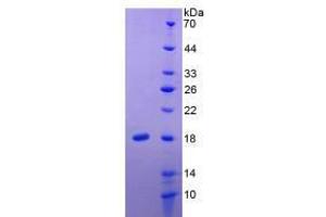 Figure. (IL-24 Protein (AA 51-206) (His tag))