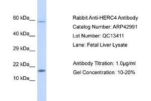 WB Suggested Anti-HERC4 Antibody   Titration: 1.