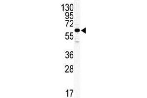 Western blot analysis of ILK2/ILK1 antibody and HeLa lysate. (ILK 抗体  (AA 391-421))