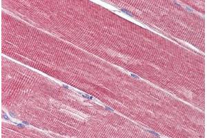 Skeletal muscle, Human: Formalin-Fixed, Paraffin-Embedded (FFPE) (IDE 抗体  (AA 222-233))