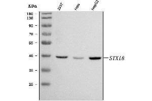 Western blot analysis of Syntaxin 18/STX18 using anti-Syntaxin 18/STX18 antibody (ABIN7599259).