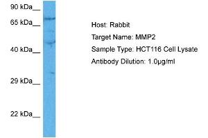 Host:  Rabbit  Target Name:  MMP2  Sample Tissue:  Human HCT116 Whole Cell  Antibody Dilution:  1ug/ml (MMP2 抗体  (C-Term))