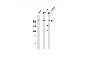 All lanes : Anti-DAG1 Antibody (C-term) at 1:2000 dilution Lane 1: Hela whole cell lysate Lane 2: MCF-7 whole cell lysate Lane 3: SH-SY5Y whole cell lysate Lysates/proteins at 20 μg per lane. (Dystroglycan 抗体  (C-Term))