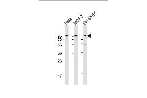 Dystroglycan 抗体  (C-Term)