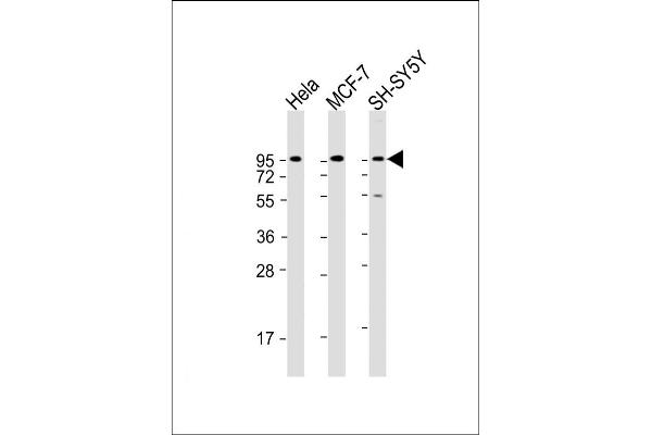 Dystroglycan 抗体  (C-Term)