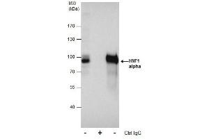 IP Image Immunoprecipitation of HNF1 alpha protein from HepG2 whole cell extracts using 5 μg of HNF1 alpha antibody [N1N3], Western blot analysis was performed using HNF1 alpha antibody [N1N3], EasyBlot anti-Rabbit IgG  was used as a secondary reagent.