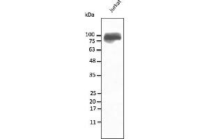 Western Blotting (WB) image for anti-Integrin beta 2 (ITGB2) (N-Term) antibody (ABIN7273029) (Integrin beta 2 抗体  (N-Term))