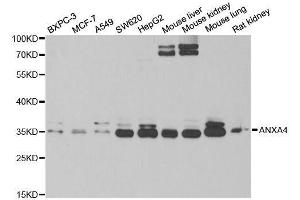 Western blot analysis of extracts of various cell lines, using ANXA4 antibody. (Annexin IV 抗体  (AA 112-321))