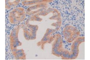IHC-P analysis of Mouse Ovary Tissue, with DAB staining. (PDGFRB 抗体  (AA 337-583))