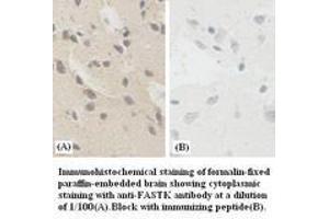Image no. 1 for anti-Fas-Activated serine/threonine Kinase (FASTK) antibody (ABIN791134) (FASTK 抗体)