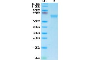 Mouse NKG2A&CD94 on Tris-Bis PAGE under reduced condition. (NKG2A & CD94 (AA 98-244) protein (mFc Tag))