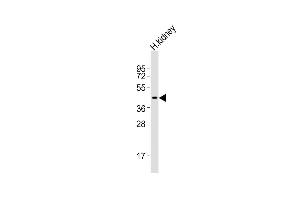 Western Blotting (WB) image for anti-Indoleamine 2,3-Dioxygenase 2 (IDO2) (AA 267-295), (C-Term) antibody (ABIN656340)