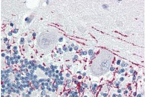 Human Brain, Cerebellum (formalin-fixed, paraffin-embedded) stained with MBP antibody ABIN364503 at 1:100 followed by biotinylated goat anti-rabbit IgG secondary antibody ABIN481713, alkaline phosphatase-streptavidin and chromogen. (MBP 抗体)