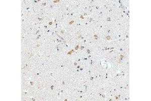 IHC analysis of RPL29 using anti-RPL29 antibody (ABIN7600993). (RPL29 抗体  (AA 27-153))