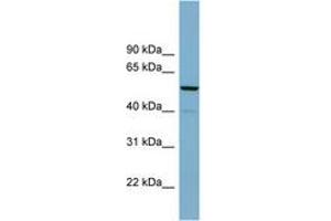 Image no. 1 for anti-CDK5 Regulatory Subunit Associated Protein 1 (CDK5RAP1) (AA 92-141) antibody (ABIN6742000) (CDK5RAP1 抗体  (AA 92-141))