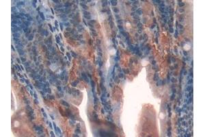 Used in DAB staining on fromalin fixed paraffin- embedded spleen tissue (Galectin 9 抗体  (AA 194-322))