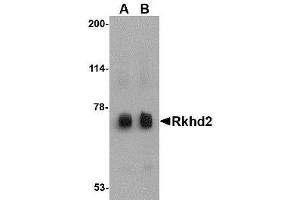 Image no. 1 for anti-Mex-3 Homolog C (C. Elegans) (MEX3C) (C-Term) antibody (ABIN341683)