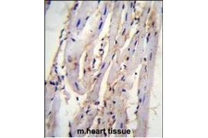 STX19 Antibody (C-term) (ABIN655437 and ABIN2844972) immunohistochemistry analysis in formalin fixed and paraffin embedded m. (Syntaxin 19 抗体  (C-Term))