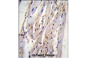 STX19 Antibody (C-term) (ABIN655437 and ABIN2844972) immunohistochemistry analysis in formalin fixed and paraffin embedded m. (Syntaxin 19 抗体  (C-Term))