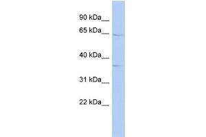 WB Suggested Anti-KIAA1191 Antibody Titration: 0. (KIAA1191 抗体  (Middle Region))
