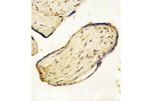 Formalin-fixed and paraffin-embedded human Placenta tissue reacted with CD73 (NT5E) Antibody (C-term), which was peroxidase-conjugated to the secondary antibody, followed by AEC staining. (CD73 抗体  (C-Term))