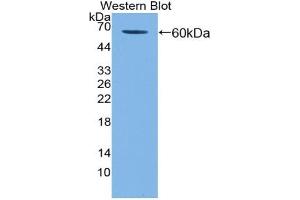Western blot analysis of the recombinant protein. (KIR2DL3 抗体  (AA 22-342))
