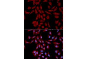 Immunofluorescence analysis of U2OS cells using UBE2I antibody. (UBE2I 抗体  (AA 1-158))