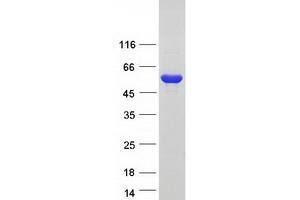Western Blotting (WB) image for Dopa Decarboxylase (Aromatic L-Amino Acid Decarboxylase) (DDC) (Transcript Variant 2) protein (Myc-DYKDDDDK Tag) (ABIN2714250)