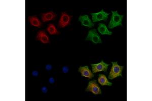 ABIN7094337 and ABIN7098384 staining HepG2 cells by IF/ICC.